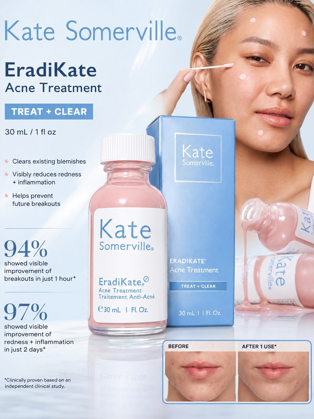 Kate Somerville EradiKate Acne Treatment